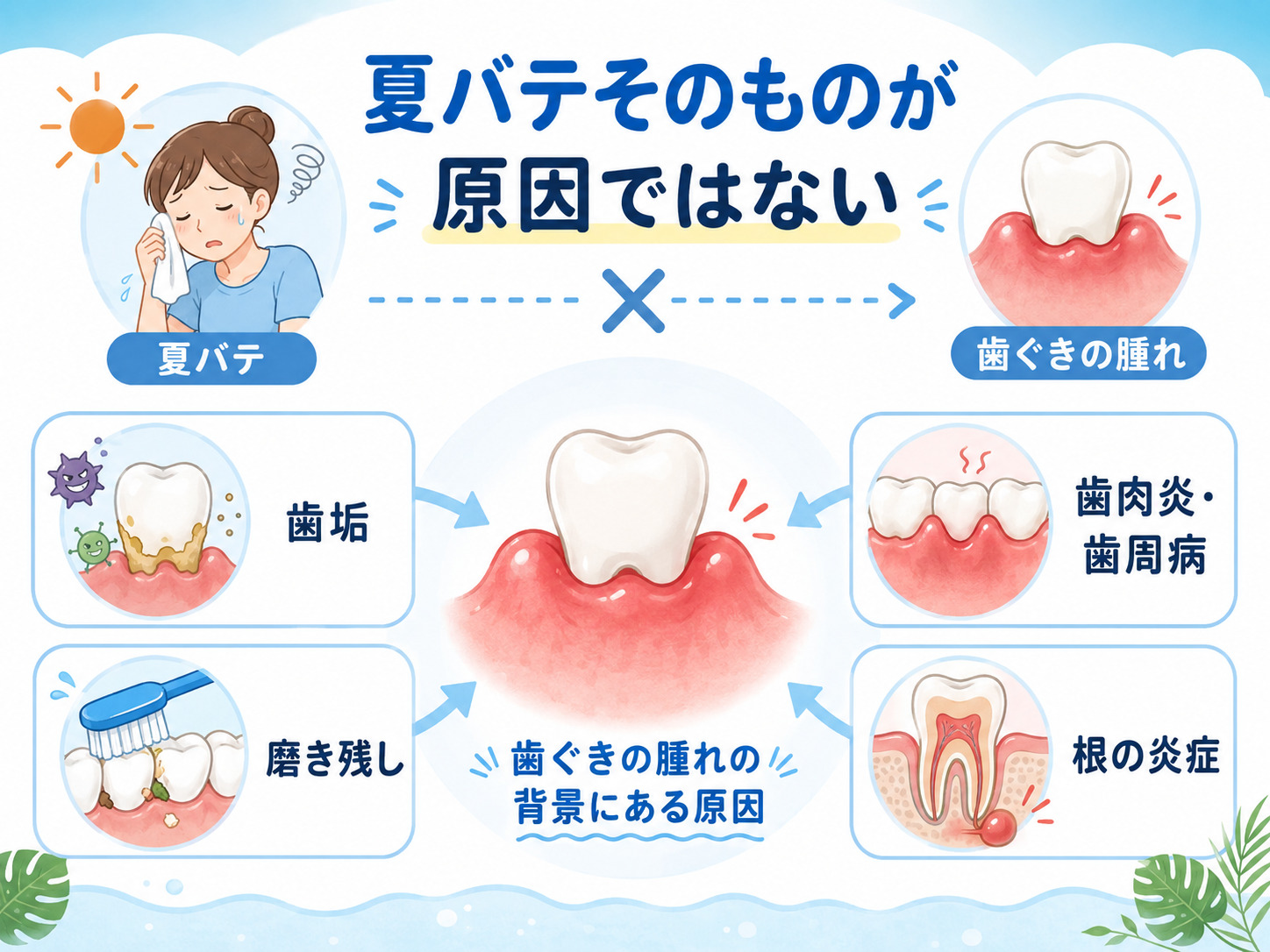 歯ぐきの腫れにつながる歯垢・歯周病・磨き残し・歯の根の炎症を示した図
